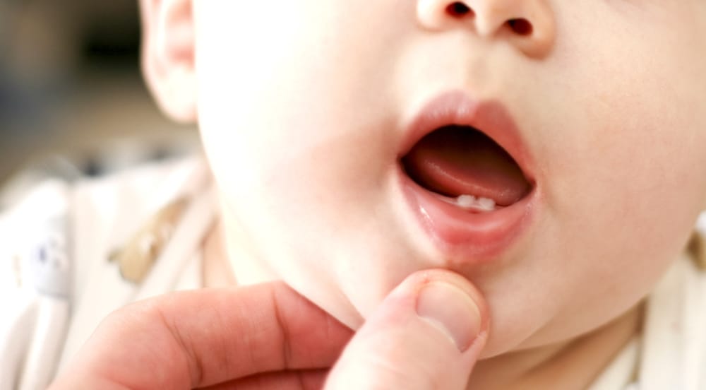赤ん坊の生えかけの歯